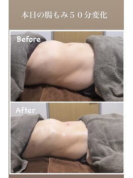 グレースヒーリング(GRACE HEALING)/本日の腸もみ