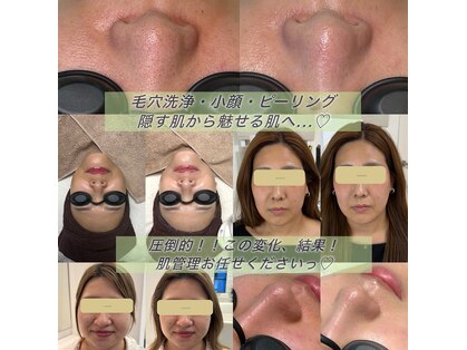 ベルエス(bell.s)の写真