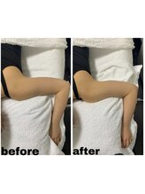 エクスクラメーションマーク(!!!)/ボディー二の腕