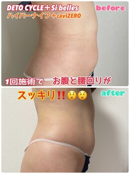 ルミネ(Lumine)/お腹と背中をスッキリ変化！！