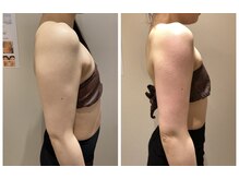 エイシスグロウ(asis glow.)/効果写真