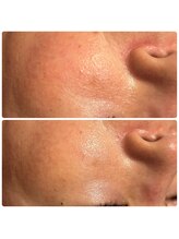 リコ(Relaxation Boutique LICO)/光フェイシャルとの相乗効果◎