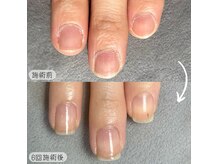 マイカネイルズ(maika nails)の雰囲気（最強のネイルケア3ヶ月コースで爪のお悩みとサヨナラ♪）