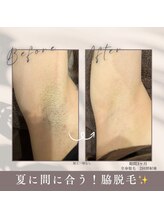 モアトゥインクル 福山神辺店(MORE twinkle)/両脇