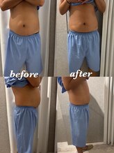 マホロバ セカンド(mahoroba 2nd)/男性もスッキリ腸マッサージ