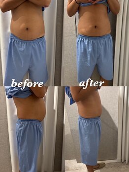 マホロバ セカンド(mahoroba 2nd)/男性もスッキリ腸マッサージ