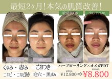 成宮鍼灸整骨院