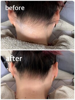 レイワックススタジオ(Lei wax studio)/うなじ脱毛