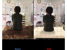 ストレチックス 近江八幡店/肩甲骨周りのコリ、首の痛み撃退