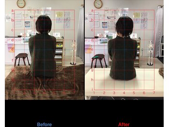 ストレチックス 近江八幡店/肩甲骨周りのコリ、首の痛み撃退