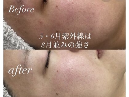 イリゼ(IRISE)の写真