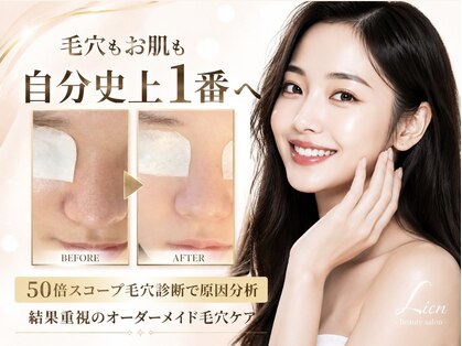 リアン(Lien)の写真