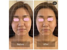 ラグナブルー(Laguna blue)/美顔調整でお顔の歪みをリセット