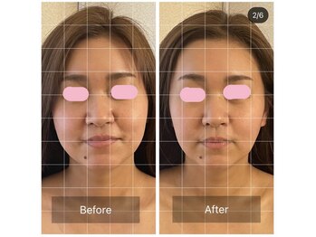 ラグナブルー(Laguna blue)/美顔調整でお顔の歪みをリセット