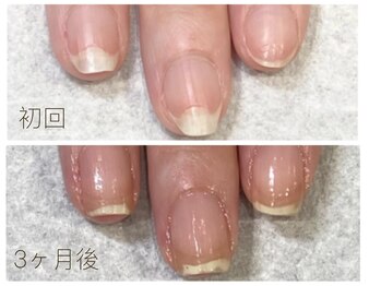 アウラ ネイル ファクトリー(aura nail factory)/最強のネイルケア(自爪育成)赤羽
