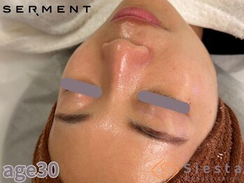 シエスタ(siesta)/セルマン艶珠肌トリートメント