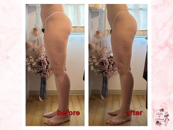 サロンドモアロ(Salon de Moaro)/Before/After