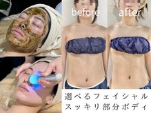 サロン ド ブラン アオヤマ(Salon de BLANC AOYAMA)/フェイシャル＆ボディ組み合わせ