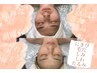 隔離・ダウンタイム無し/小顔エイジングハーブピーリング　顔のみ　５０分