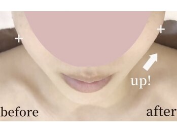 ガーデン(Garden)/滋賀彦根/たるみ改善専門Garden