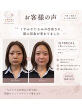 小顔美肌ファクトリー 梅田院/お客様の声