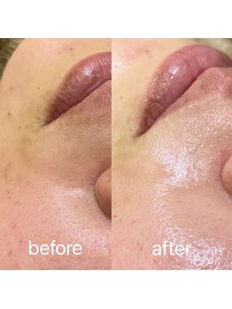 ブリエボ ニータ(BRILLER BONITA)/