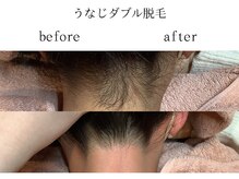 サロン ド アピール(salon de APPEAL)/