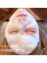 セレブリボーン 大阪ボーテ/韓国肌美容「角質整理」の様子