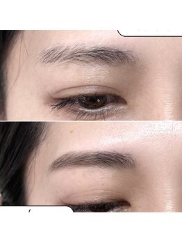 ハル ハロ(halu halo)/before→after