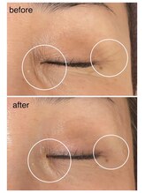 グリンプラス(grin+)/ハーブ/桂駅/フェイシャル