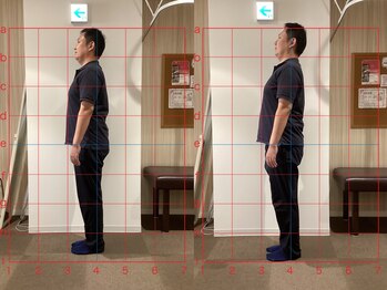 キラリ(KIRARI)/姿勢改善