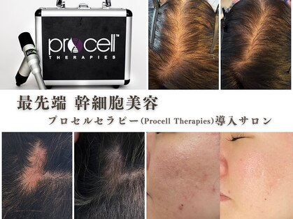 ラナン パラフューズ(Ranun's PARAFUSE.)の写真