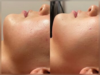 ゾーンビューティーハウス 松戸店(ZONE BEAUTY HOUSE)/