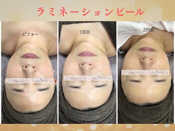 アルカンジュ(Archange)/韓国発ラミネーションピール