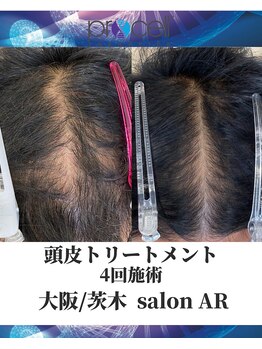 メンズサロンアール(AR)/プロセルセラピーズ