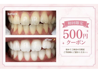 エクシアホワイトニング 武蔵小杉店の写真