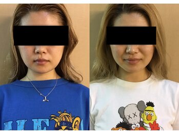 わせだのもり整骨院の写真/表情筋を鍛え、たるみケアを叶える。美しいフェイスラインと美しい表情へ導きます◎