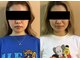 わせだのもり整骨院の写真/表情筋を鍛え、たるみケアを叶える。美しいフェイスラインと美しい表情へ導きます◎