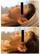 エイシスグロウ(asis glow.)/効果写真