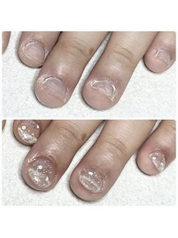【美爪育成】深爪・噛み爪改善