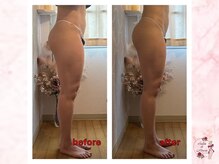 サロンドモアロ(Salon de Moaro)/Before/After