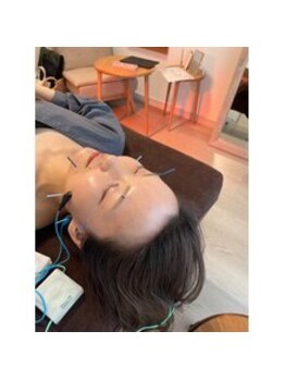 ハリファ鍼灸院 横浜関内院(HariFa鍼灸院)/美容施術・美容鍼