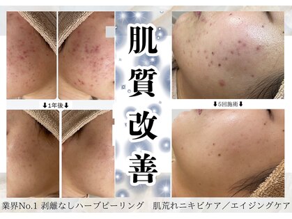 イミュ(Imyu.)の写真