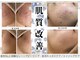 イミュ(Imyu.)の写真