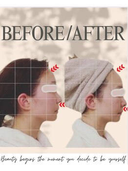 エイエービジュー(Aa.bijou)/30代 女性