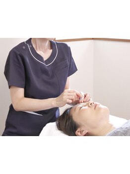 鍼灸施術を受けたい