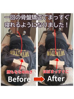 ラヴィフルリル(Ravi FleuRir)/骨盤から整う美容整体の変化