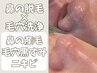 1回でちゅるん♪毛も取れる毛穴洗浄★【鼻のみWAX+全顔毛穴洗浄】16900→5980