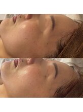 ヴィアス(Vias)/リフトアップもおまかせ下さい