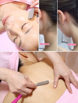 レディースシェービングエステ サンドリオンの写真/【イベント前にオススメ！】後ろ姿のキレイ魅せ♪ 袴やドレスを着るなら《キャミラインコース》